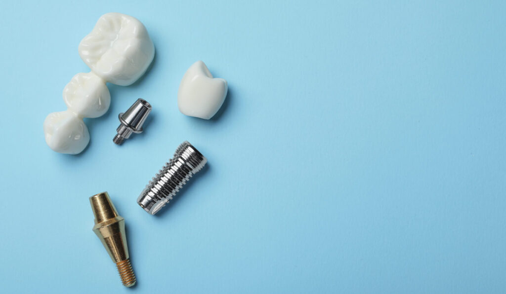 Dental implants cost explained