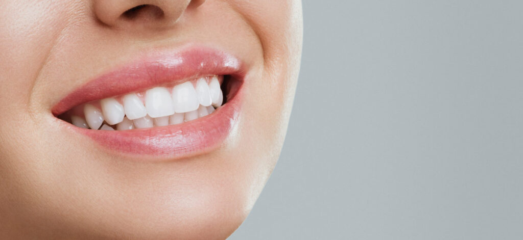 The benefits of composite bonding
