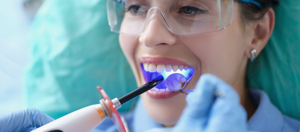 Dental bonding