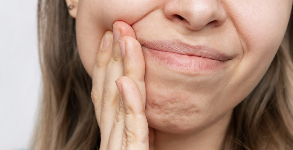 Potential risks and complications
