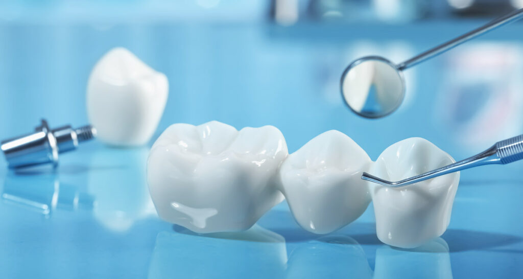 Types of dental crowns available