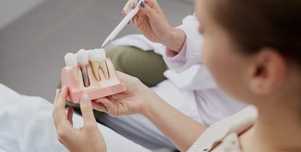 how much are dental implants