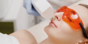 laser hair removal finance