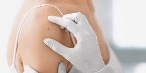 private dermatologist