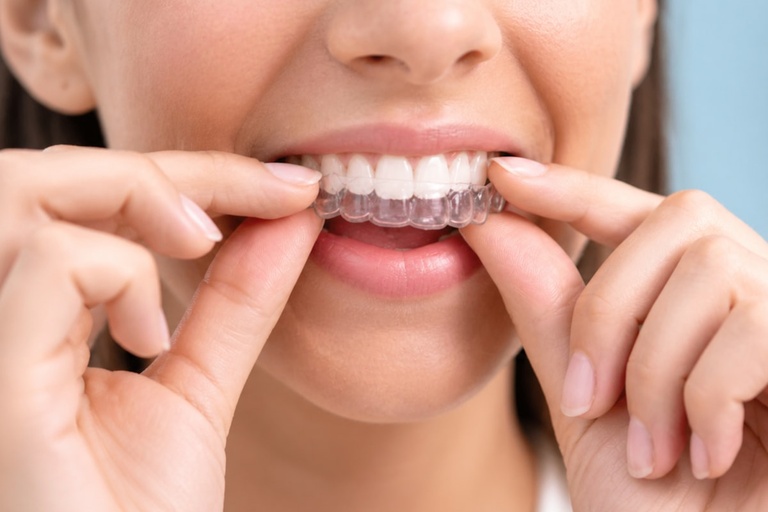 New Forest Family Dental 2