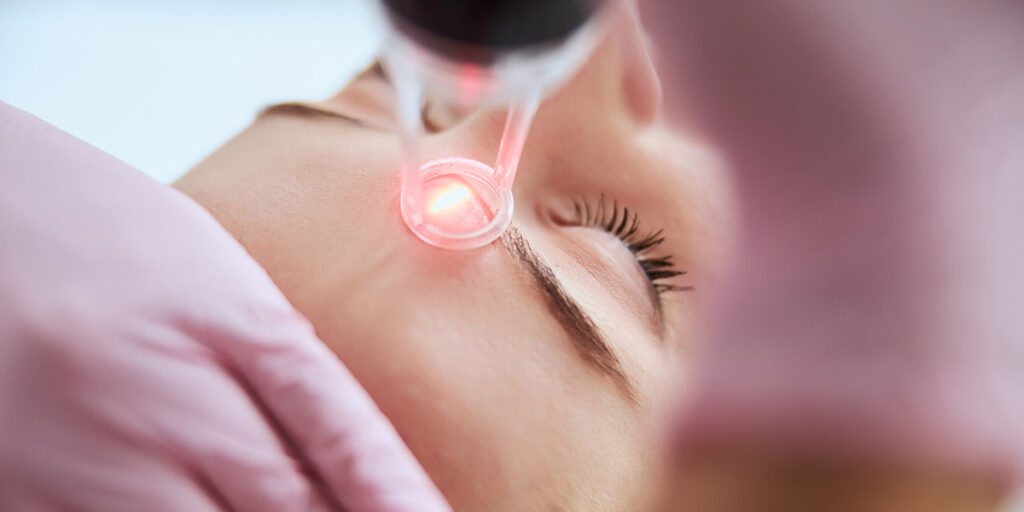 laser skin treatment